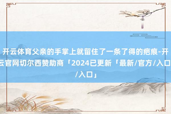 开云体育父亲的手掌上就留住了一条了得的疤痕-开云官网切尔西赞助商「2024已更新「最新/官方/入口」
